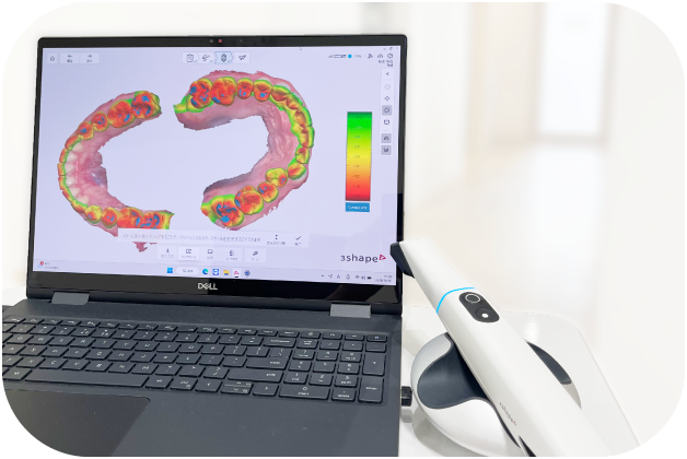 口腔内スキャナー（TRIOS 5）